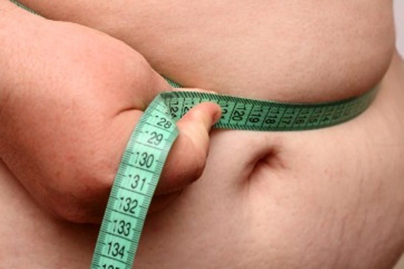 מהי השמנת יתר?